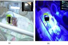 کاربرد هوش مصنوعی برای شناسایی و کنترل نوزادان نارس