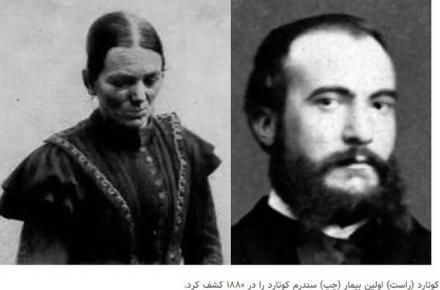 بیماری شگفت انگیز این زن ۴۳ ساله: فکر می کرد روح ندارد!