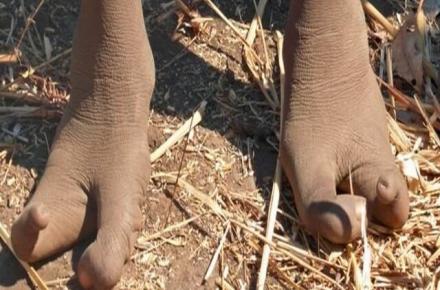 پاهای شترمرغی عجیب قبیله‌ای در آفریقا(+عکس)